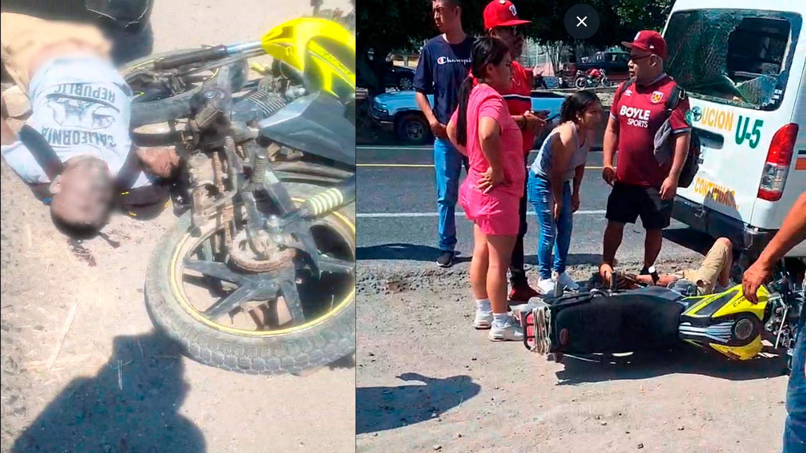 Motociclista resulta herido en choque en la Izúcar – Atlixco