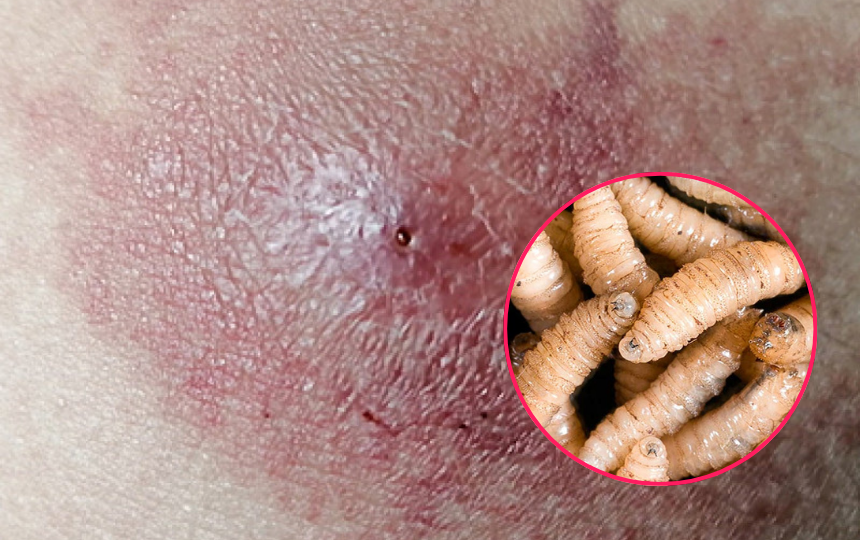 Confirman segundo caso de miasis por gusano barrenador en Puebla