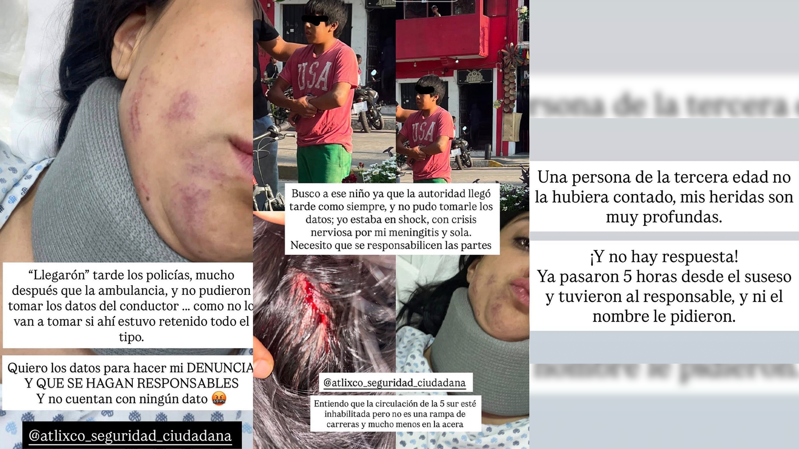 Mujer denuncia omisión tras accidente en Atlixco