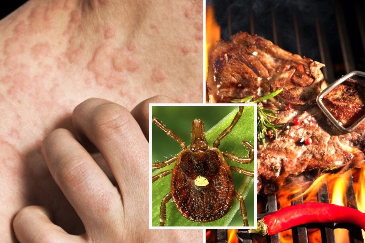 Plaga de garrapatas provoca alergia a la carne