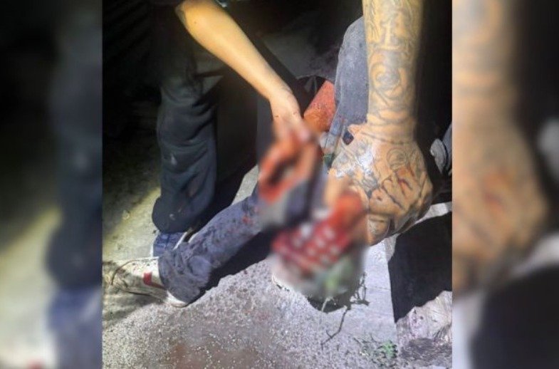 Localizan a un hombre herido en la colonia Cruz Verde