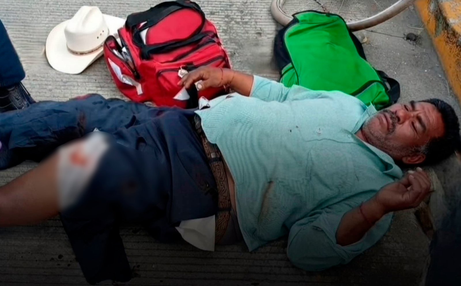 Ciclista herido tras ser embestido en Izúcar